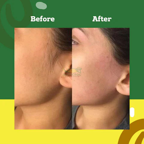 Turmeric Facial Hair Remove Powder - Buy 1 Get 1 FREE - 2 Packets