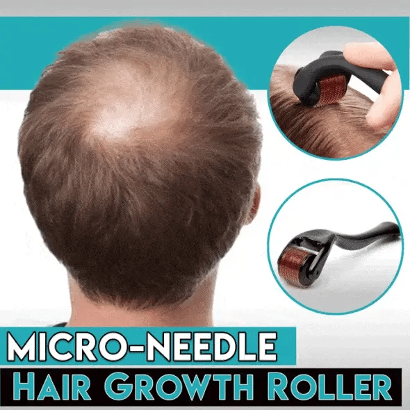 Hair Growth Derma Roller 🖤OFFER PRICE