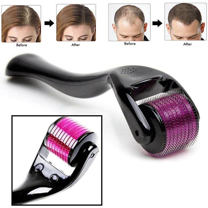 Hair Growth Derma Roller 🖤OFFER PRICE