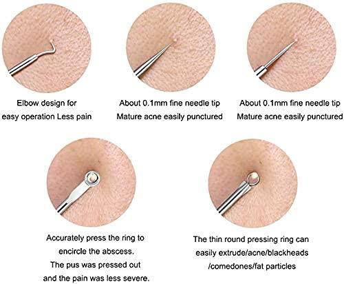 Stainless Steel Blackhead Remover Tool 👌 Set of 4