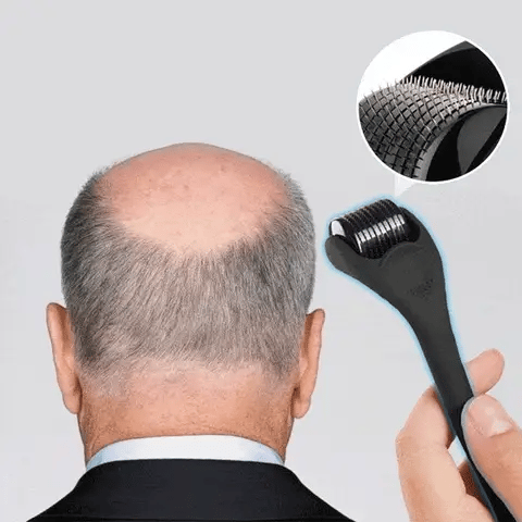 Hair Growth Derma Roller 🖤OFFER PRICE
