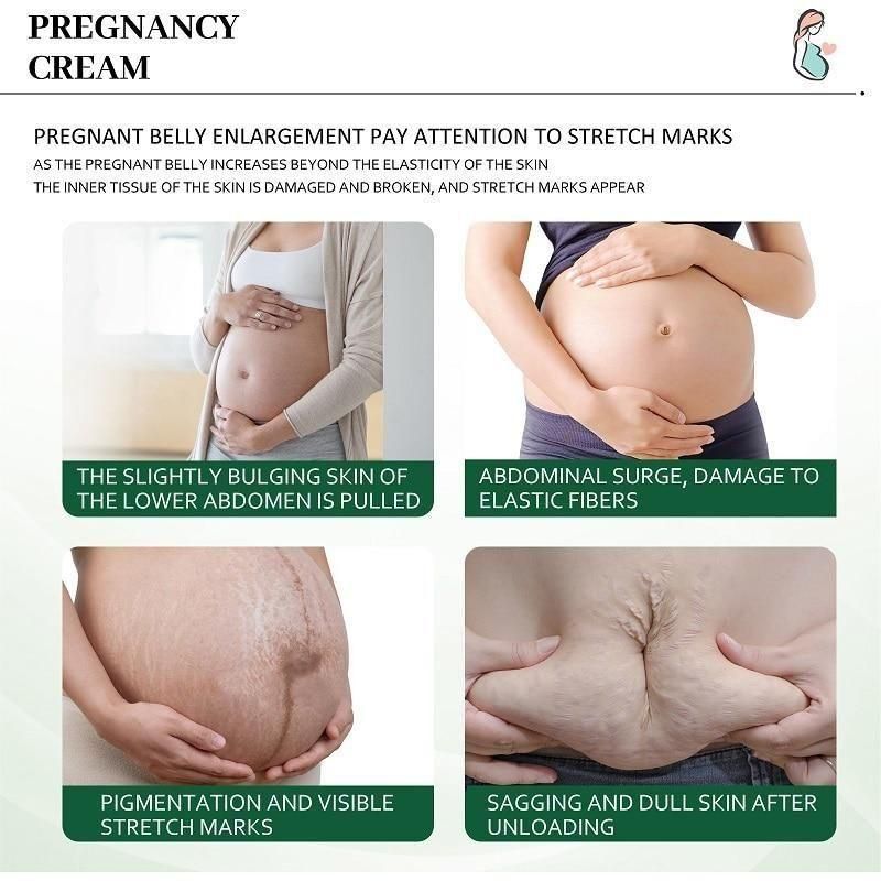 Stretch Mark Cream - Combo Offer - Pack of 2