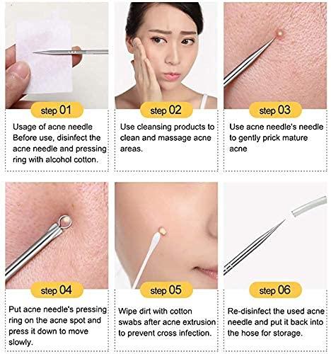 Stainless Steel Blackhead Remover Tool 👌 Set of 4