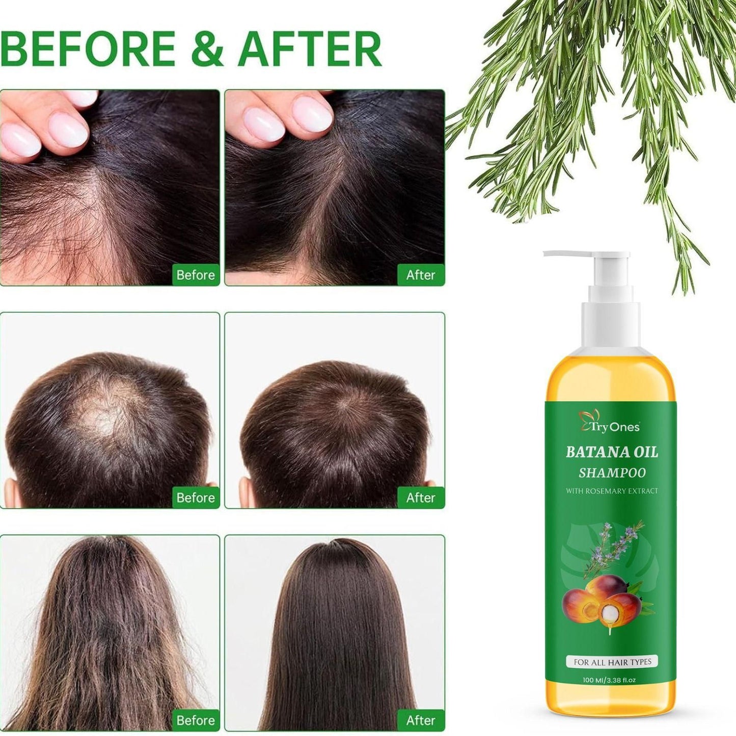 Buy 1 Get 1 FREE ✅ Batana Oil Shampoo with Rosemary Extract - OFFER !