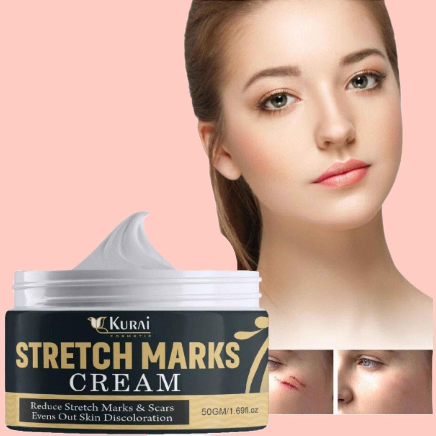 Stretch Mark Cream - Combo Offer - Pack of 2