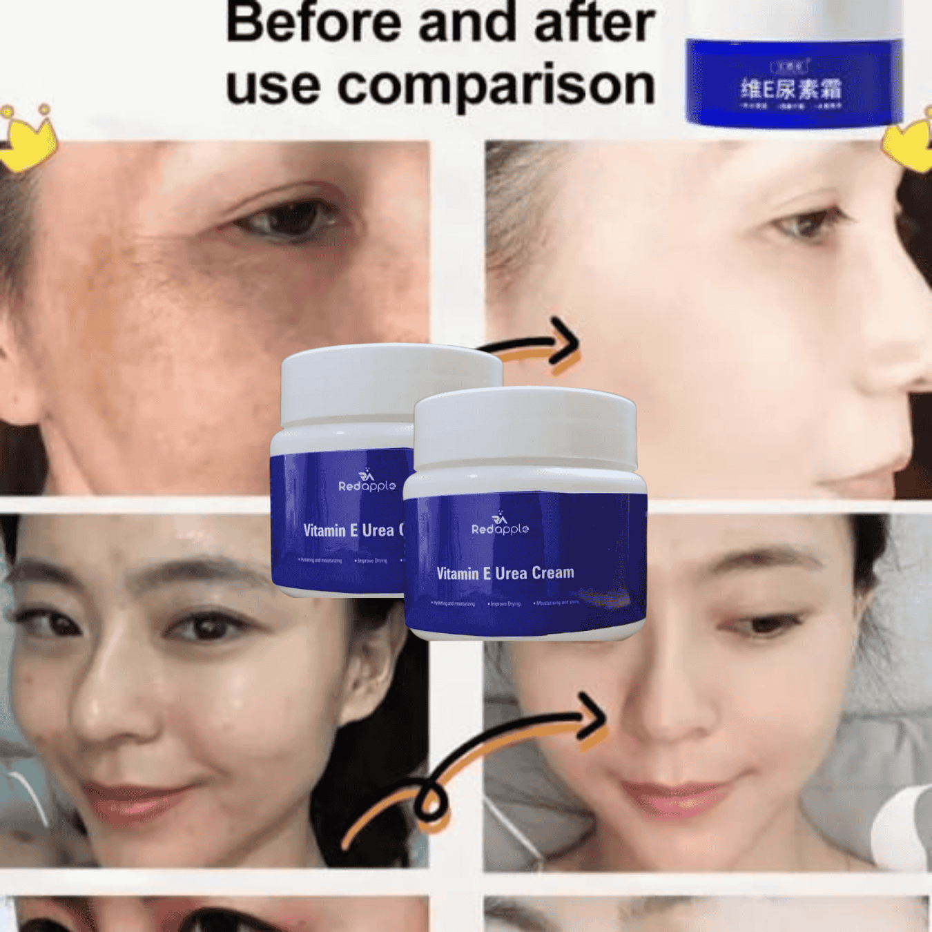 Vitamin E Urea Spot Fading Cream 😍 Buy 1 Get 2 😍 OFFER TODAY