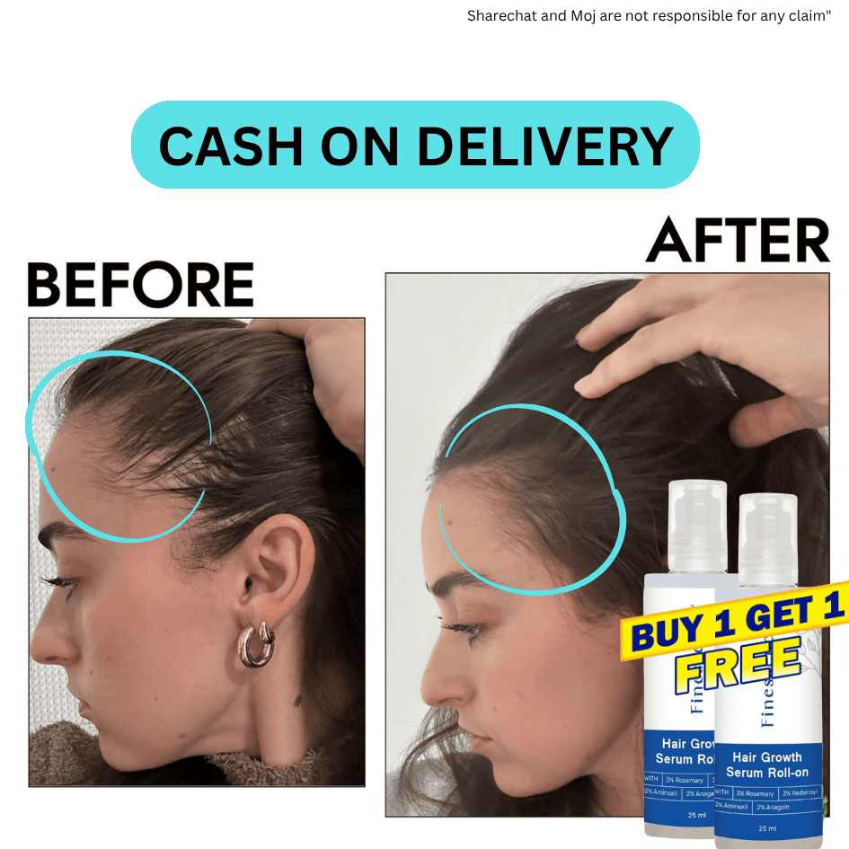 Roll On - Hair Growth Serum - PACK OF 2