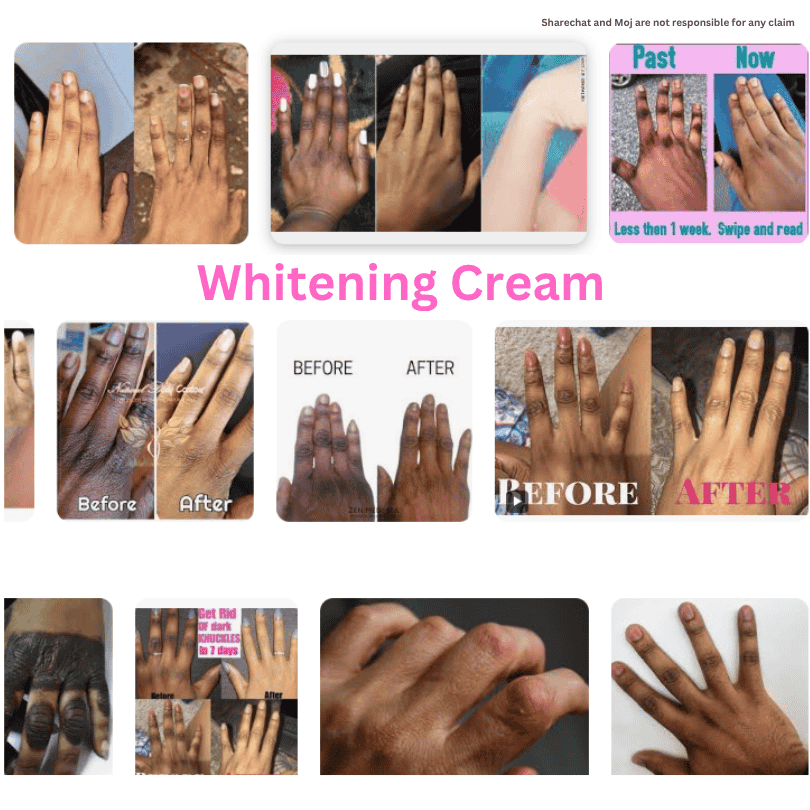 BUY 1 GET 1 FREE - Body & Intimate Area Whitening Cream