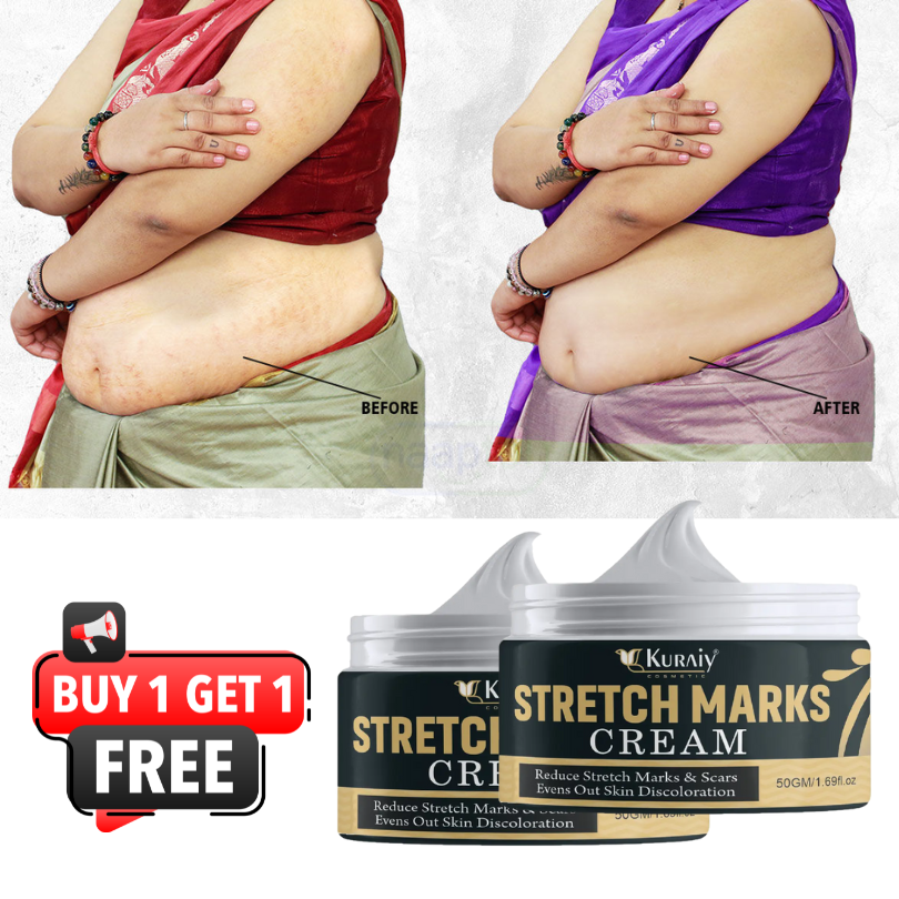 Stretch Mark Cream - Combo Offer - Pack of 2