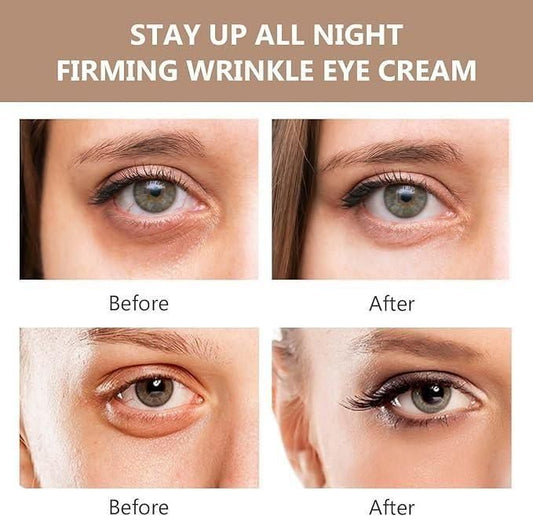 Eye Care Cream - Dark Circle Cream 🗲 OFFER TODAY