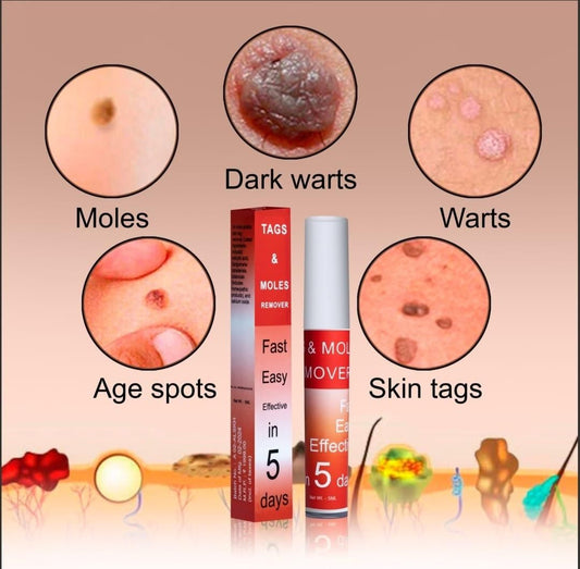 Tags & Moles Remover 🔥 Buy 1 Get 1 FREE