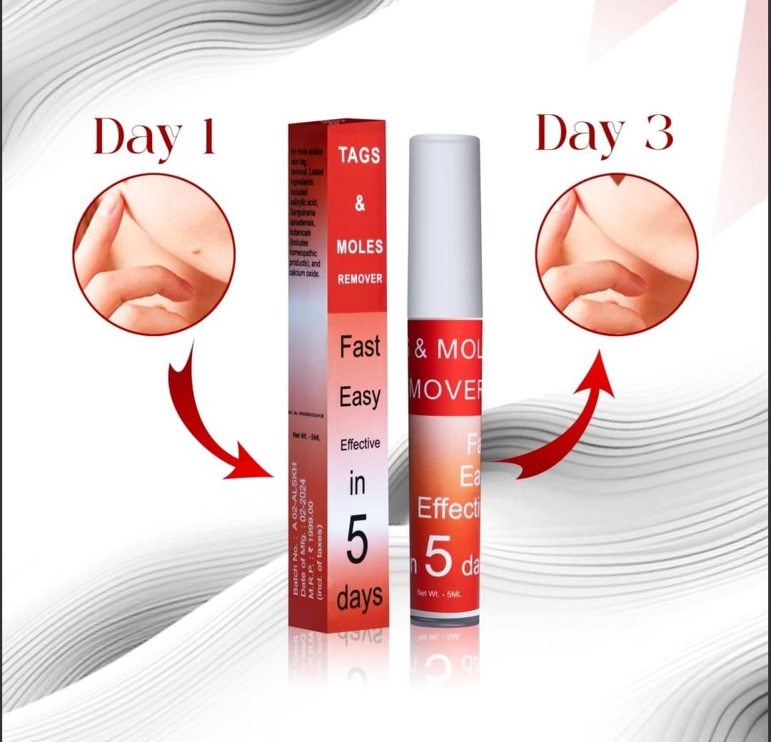 Tags & Moles Remover 🔥 Buy 1 Get 1 FREE