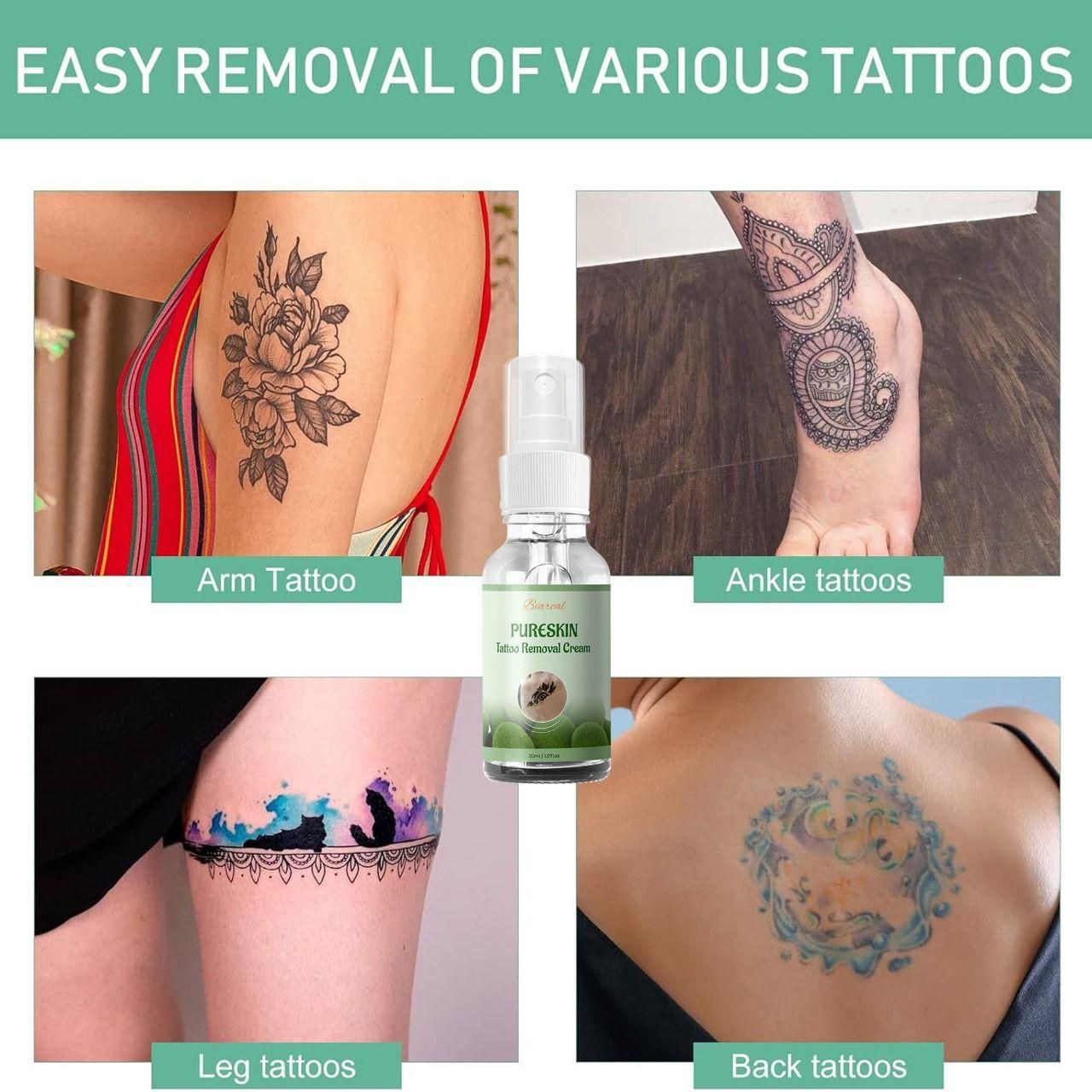 Tattoo Removal Cream - Best Offer Today