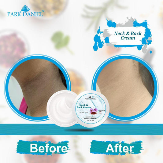 Skin Whitening Cream - Neck and Back - Dark Patch - Tan Removal - BEST OFFER