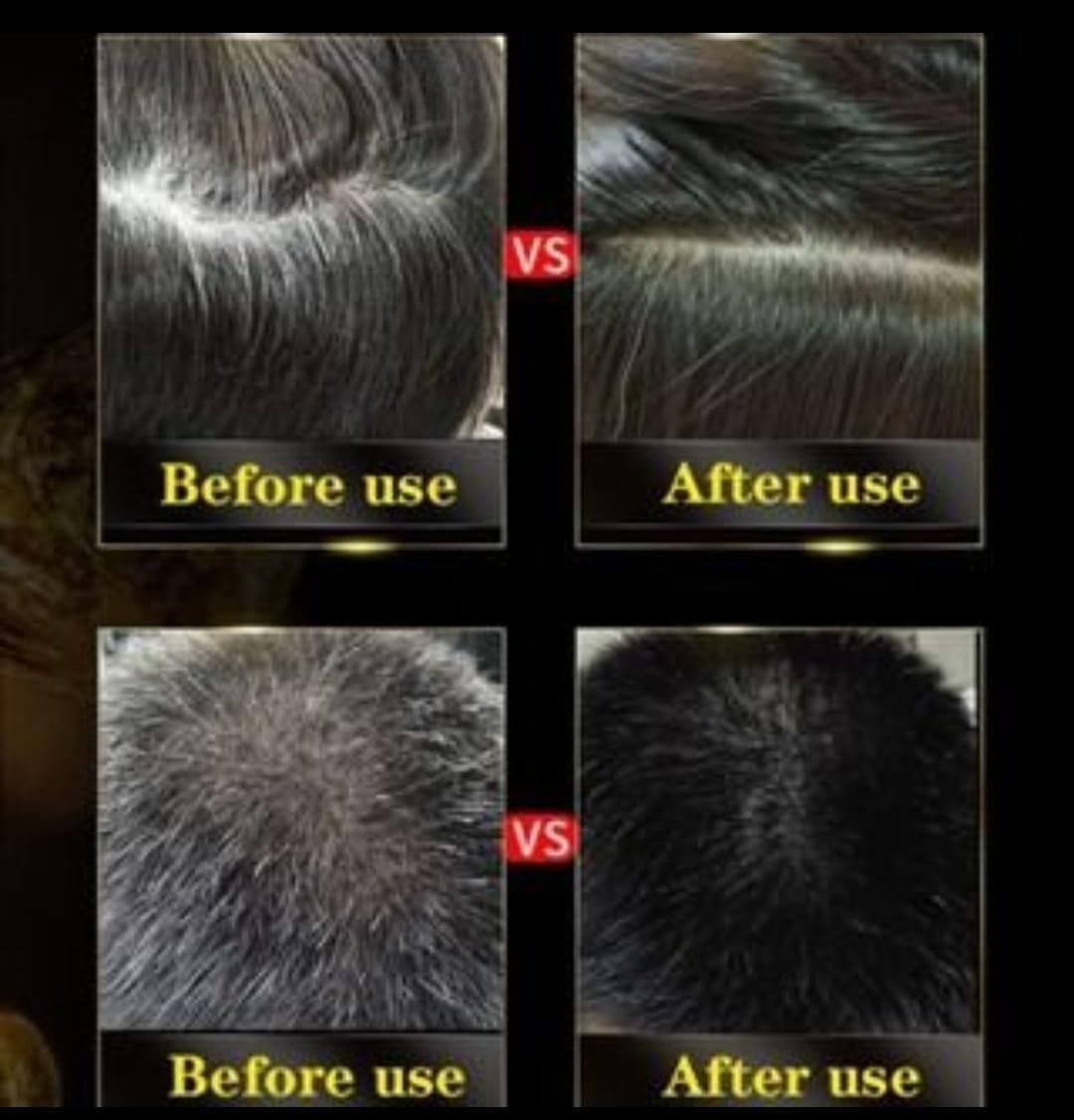 Black Hair Shampoo 3 in 1 - BUY 1 GET 1 FREE - 2 Bottles